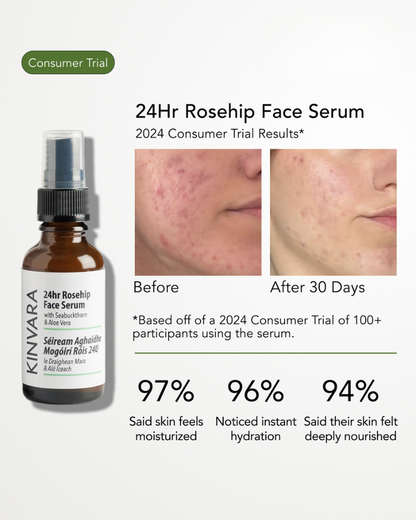 Kinvara 24Hr Rosehip Face Serum 30ml