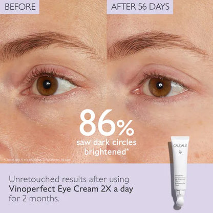 Vinoperfect Dark Circle Brightening Eye Cream with Niacinamide - Caudile *New Product*